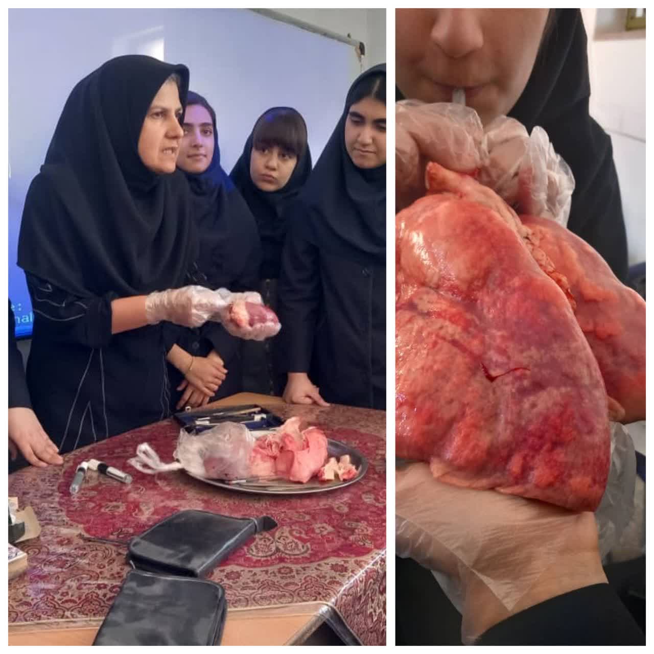 تشریح قلب وشش